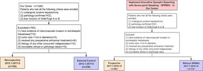 Innovative Synoptic Reporting With Seven-Point Sampling Protocol to Improve Detection Rate of Microvascular Invasion in Hepatocellular Carcinoma